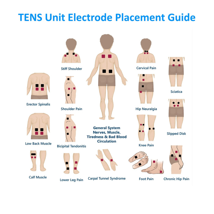 TENS Unit Electrode Placement Guide 